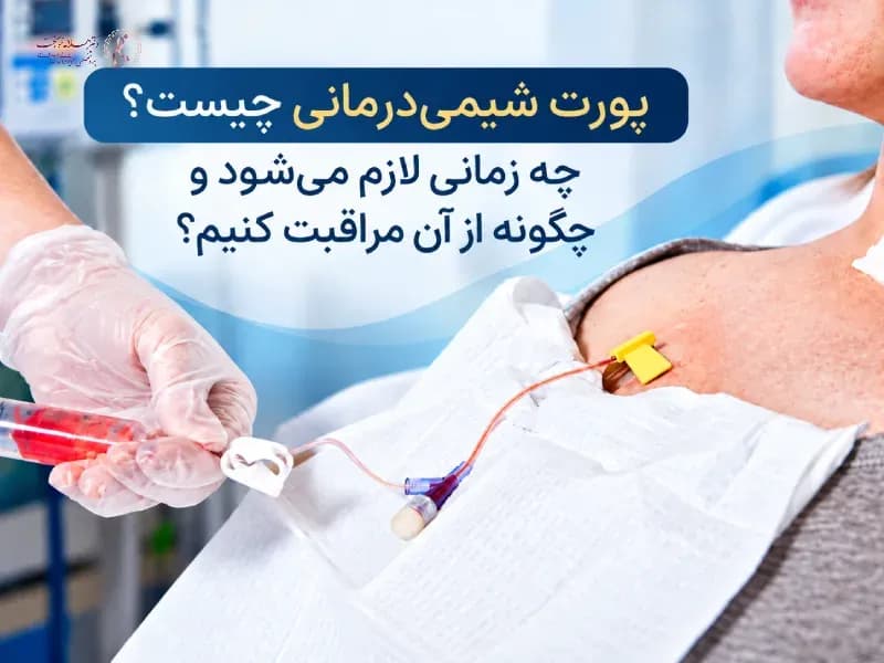 پورت شیمیدرمانی چیست